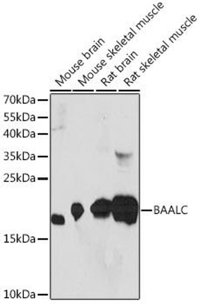 Cell Biology Antibodies 6 Anti-BAALC Antibody CAB15513