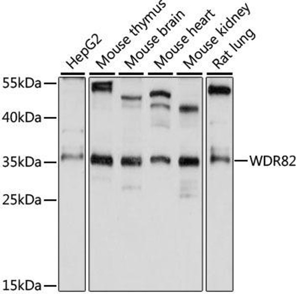 Cell Biology Antibodies 6 Anti-WDR82 Antibody CAB15518