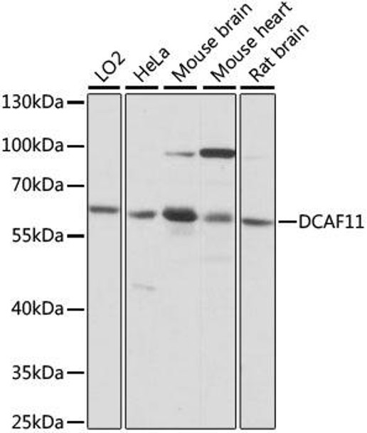 Signal Transduction Antibodies 2 Anti-DCAF11 Antibody CAB15519