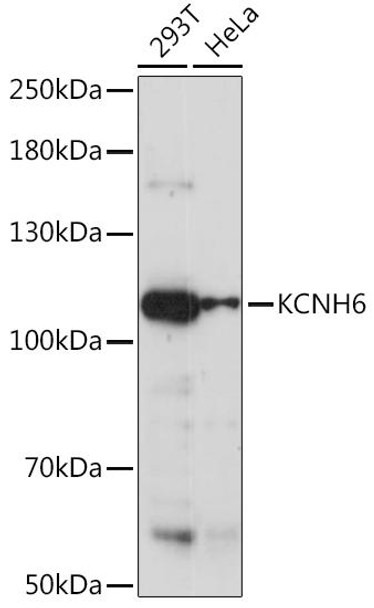 Signal Transduction Antibodies 2 Anti-KCNH6 Antibody CAB15522
