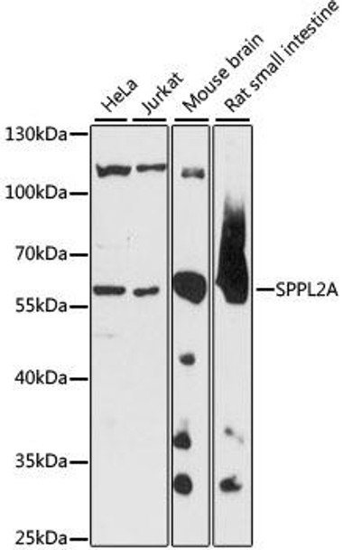 Cell Biology Antibodies 6 Anti-SPPL2A Antibody CAB15539