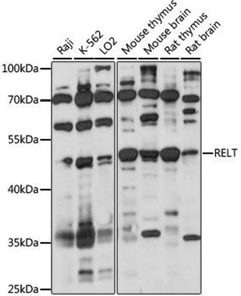 Cell Death Antibodies 1 Anti-RELT Antibody CAB15540