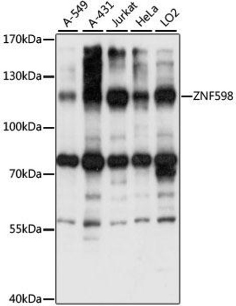 Signal Transduction Antibodies 2 Anti-ZNF598 Antibody CAB15546