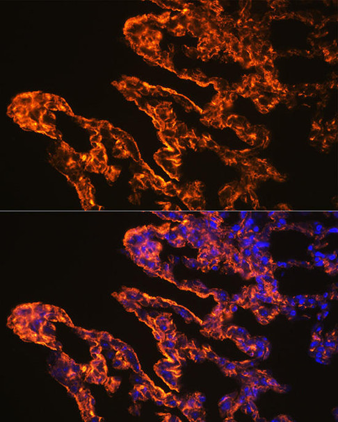 Immunology Antibodies 3 Anti-Caveolin-1 Antibody CAB1555