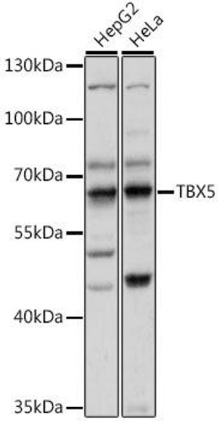 Epigenetics and Nuclear Signaling Antibodies 2 Anti-TBX5 Antibody CAB15590