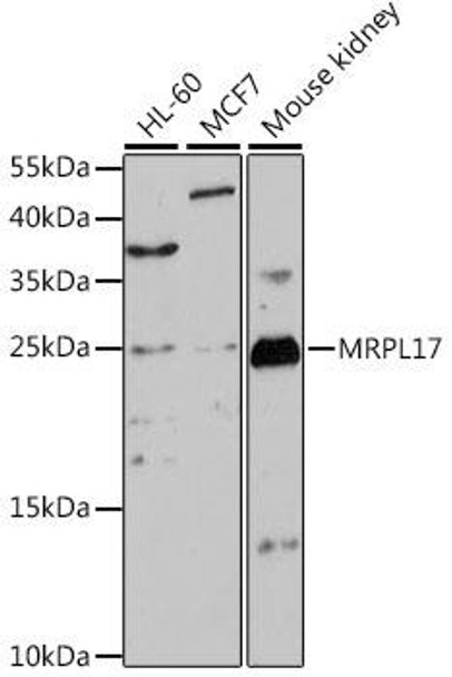 Cell Biology Antibodies 6 Anti-MRPL17 Antibody CAB15603