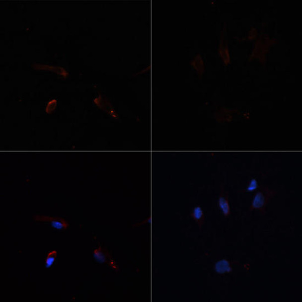 Metabolism Antibodies 1 Anti-acetyl-ACC1 Antibody CAB15606