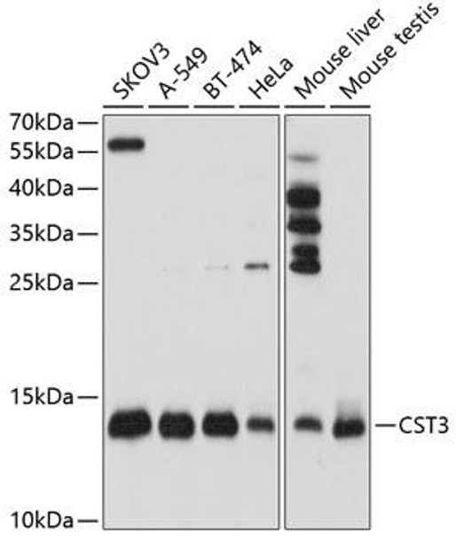 Cell Biology Antibodies 6 Anti-CST3 Antibody CAB1561