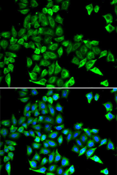 Cell Biology Antibodies 6 Anti-CST3 Antibody CAB1561