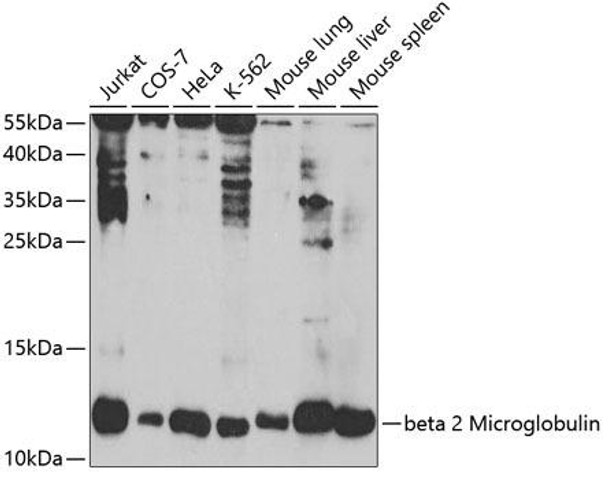 Immunology Antibodies 3 Anti-beta 2 Microglobulin Antibody CAB1562
