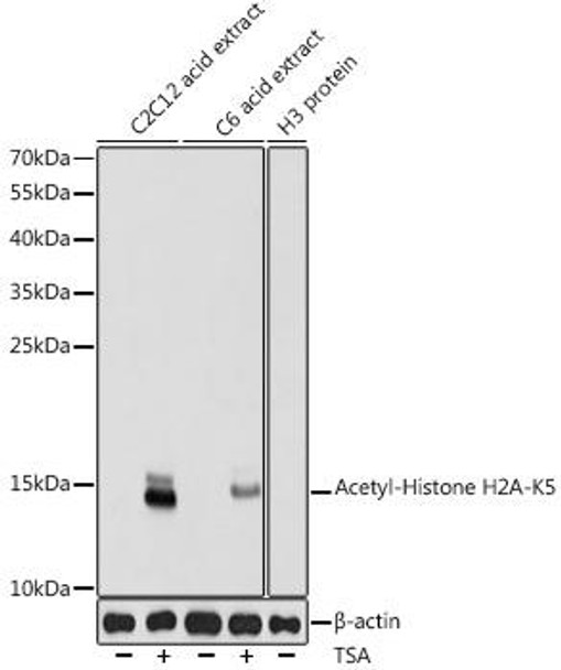 Epigenetics and Nuclear Signaling Antibodies 2 Anti-Acetyl-Histone H2A-K5 Antibody CAB15620