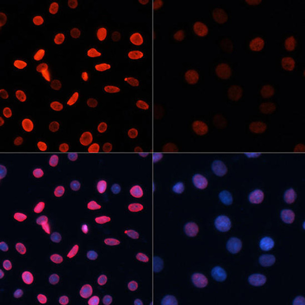 Cell Biology Antibodies 16 Anti-Acetyl-Histone H2B-K5 Antibody CAB15621