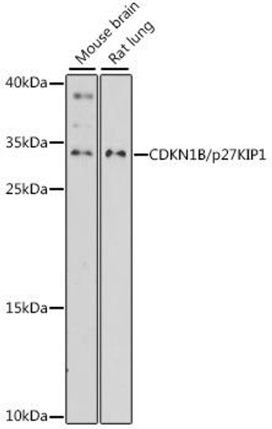 Cell Cycle Antibodies 1 Anti-CDKN1B/p27KIP1 Antibody CAB15632