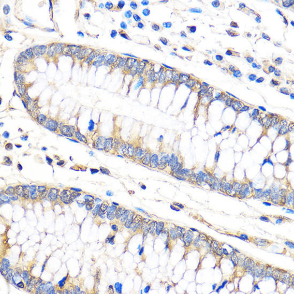 Cell Death Antibodies 1 Anti-Bax Antibody CAB15646