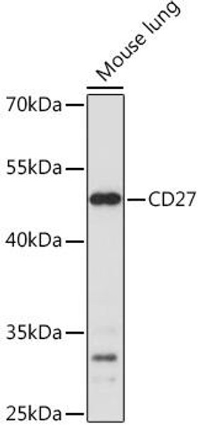 Cell Death Antibodies 1 Anti-CD27 Antibody CAB15654