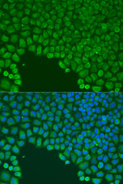 Developmental Biology Anti-CDC42 Antibody CAB15657