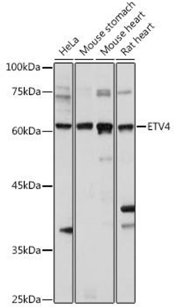 Epigenetics and Nuclear Signaling Antibodies 2 Anti-ETV4 Antibody CAB15667