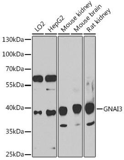 Cell Cycle Antibodies 1 Anti-GNAI3 Antibody CAB15674