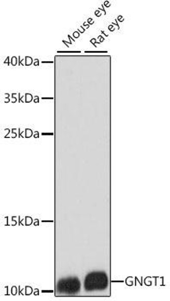 Cell Biology Antibodies 6 Anti-GNGT1 Antibody CAB15675