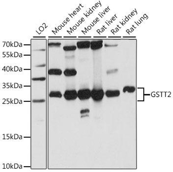Cell Biology Antibodies 6 Anti-GSTT2 Antibody CAB15678
