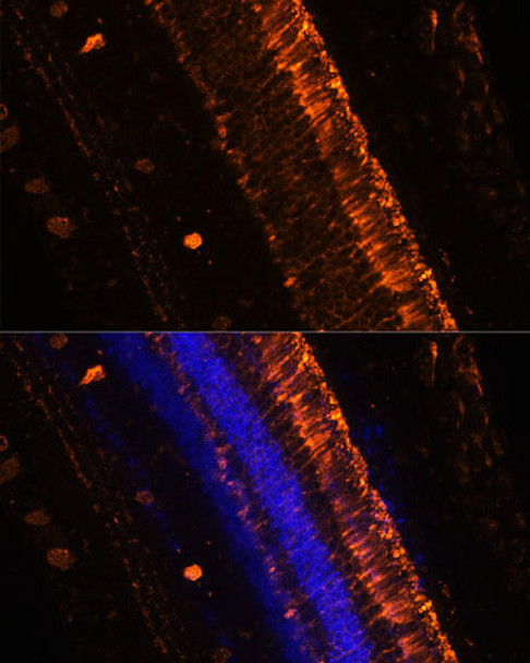 Signal Transduction Antibodies 2 Anti-KCNS2 Antibody CAB15684