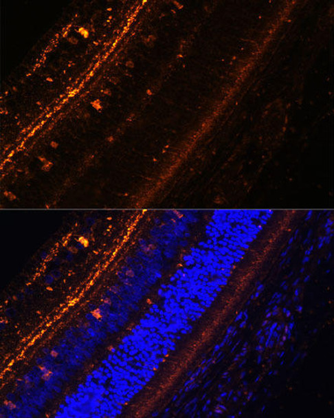 Signal Transduction Antibodies 2 Anti-KCNS2 Antibody CAB15684