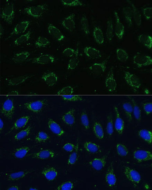 Cell Biology Antibodies 6 Anti-NDUFA4 Antibody CAB15693