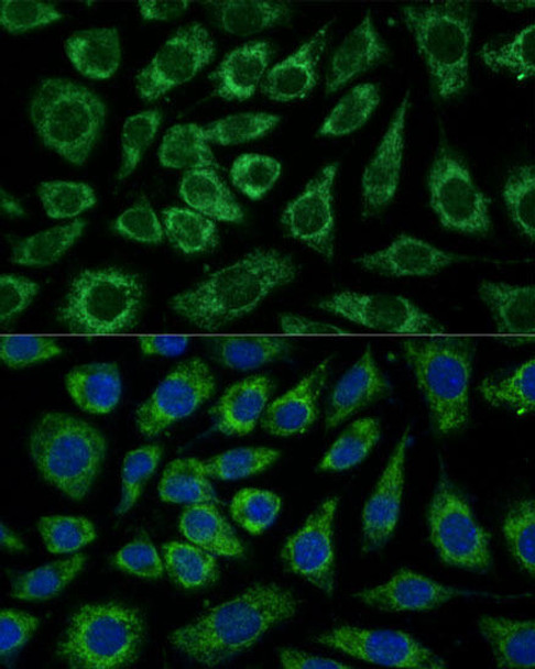 Cell Biology Antibodies 6 Anti-NDUFA4 Antibody CAB15693