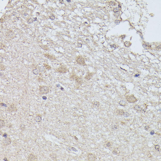 PP2A-B56delta/PR61delta/PPP2R5D Antibody | Assay Genie