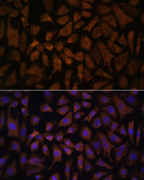 Cell Biology Antibodies 6 Anti-PPP2R5D Antibody CAB15707