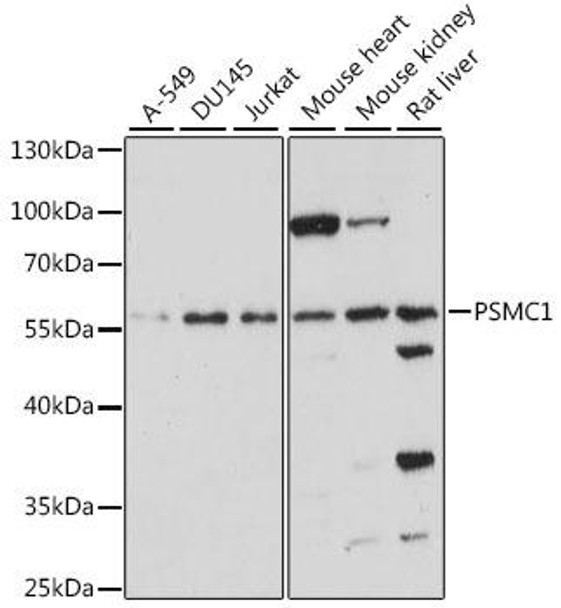 Cell Biology Antibodies 6 Anti-PSMC1 Antibody CAB15712