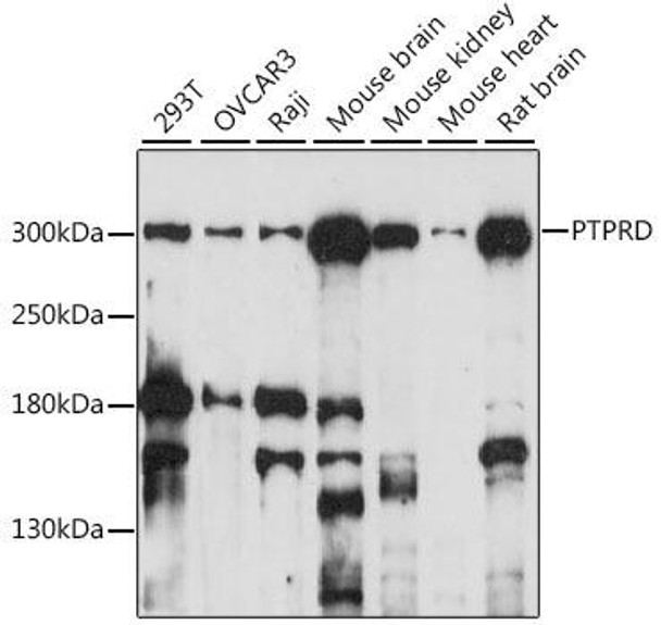 Cell Biology Antibodies 6 Anti-PTPRD Antibody CAB15713