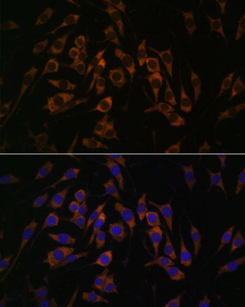 Cell Biology Antibodies 6 Anti-RPS13 Antibody CAB15720