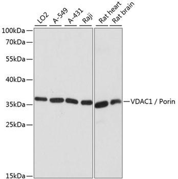 Cell Death Antibodies 1 Anti-VDAC1 / Porin Antibody CAB15735