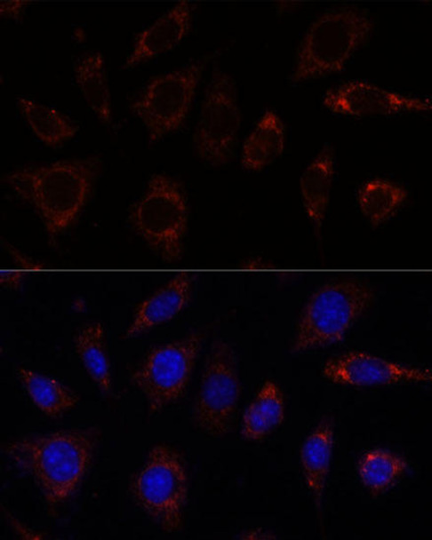 Cell Biology Antibodies 6 Anti-TBRG4 Antibody CAB15753