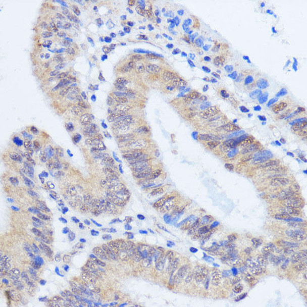 Epigenetics and Nuclear Signaling Antibodies 2 Anti-RBM39 Antibody CAB15760