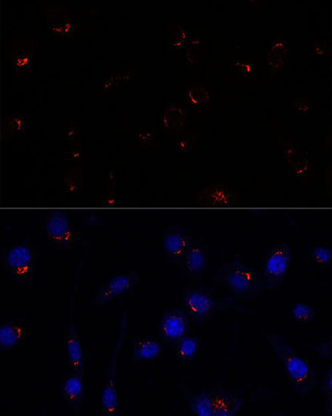 Cell Biology Antibodies 6 Anti-GOLGA5 Antibody CAB15768