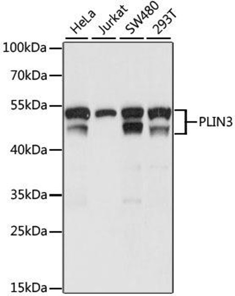 Signal Transduction Antibodies 2 Anti-PLIN3 Antibody CAB15776