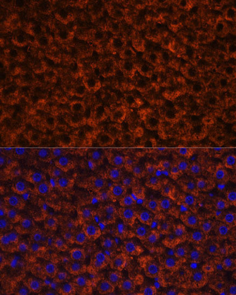 Cardiovascular Antibodies Anti-Factor IX / F9 Antibody CAB1578