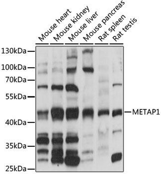 Cell Biology Antibodies 6 Anti-METAP1 Antibody CAB15796