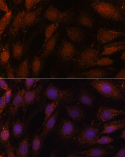 Cell Biology Antibodies 6 Anti-GCAT Antibody CAB15802