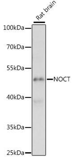 Cell Biology Antibodies 6 Anti-NOCT Antibody CAB15805