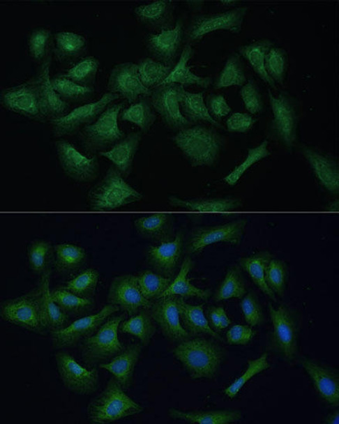 Cell Biology Antibodies 6 Anti-REXO2 Antibody CAB15808
