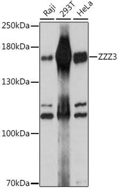 Epigenetics and Nuclear Signaling Antibodies 2 Anti-ZZZ3 Antibody CAB15809