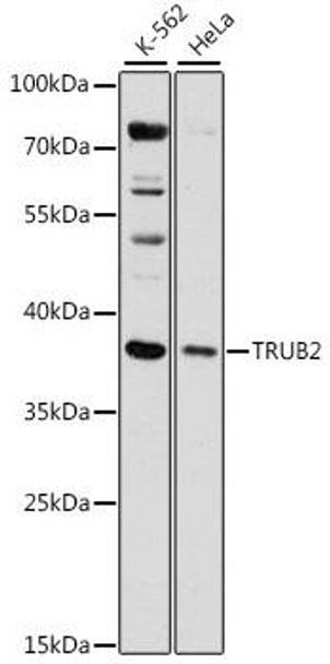 Epigenetics and Nuclear Signaling Antibodies 2 Anti-TRUB2 Antibody CAB15818