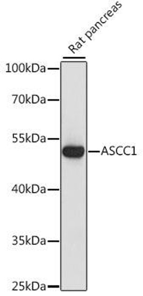 Epigenetics and Nuclear Signaling Antibodies 2 Anti-ASCC1 Antibody CAB15832