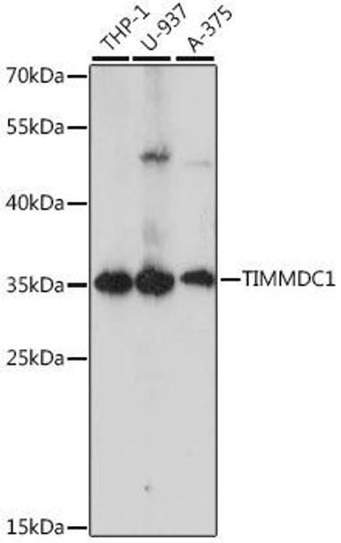 Cell Biology Antibodies 6 Anti-TIMMDC1 Antibody CAB15839