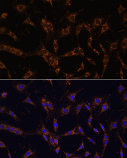 Signal Transduction Antibodies 2 Anti-UBE2J1 Antibody CAB15841