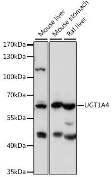 Cell Biology Antibodies 6 Anti-UGT1A4 Antibody CAB15849