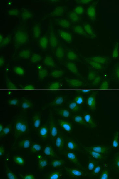 Cell Biology Antibodies 6 Anti-ABO Antibody CAB1586